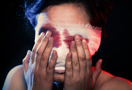 A woman presses gauze over her bleeding eyes