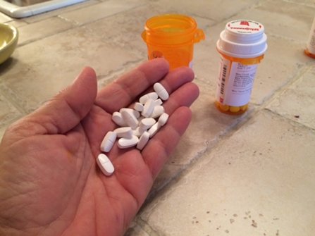 A patient holds a handful of painkillers. 