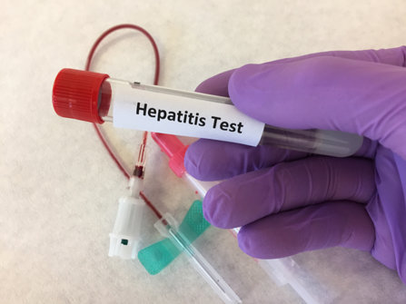Hepatitis test hand.