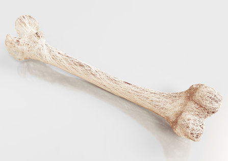 A 3D model of a bone affected by osteoporosis.
